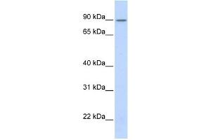 WB Suggested Anti-ZNF408 Antibody Titration:  0. (ZNF408 antibody  (Middle Region))