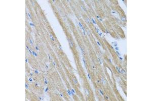 Immunohistochemistry of paraffin-embedded mouse heart using CCM2 antibody. (CCM2 antibody  (AA 1-300))