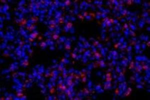 Immunofluorescent analysis of paraformaldehyde-fixed rat lung using,Claudin 10 (ABIN7073514) at dilution of 1: 800 (CLDN10 antibody)