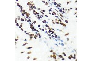 Immunohistochemistry (IHC) image for anti-Vaccinia Related Kinase 1 (VRK1) antibody (ABIN7308494) (VRK1 antibody)