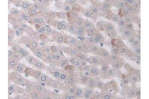 DAB staining on IHC-P; Samples: Rat Liver Tissue (COX-1 antibody  (AA 23-277))