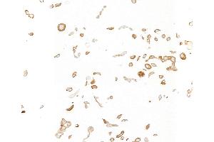 Immunocytochemistry (ICC) image for anti-Insulin-Like Growth Factor 1 Receptor (IGF1R) antibody (ABIN7795597)