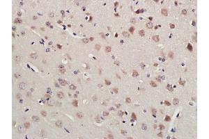 Paraformaldehyde-fixed, paraffin embedded Mouse brain; Antigen retrieval by boiling in sodium citrate buffer (pH6. (RNF213 antibody  (AA 4750-4800))