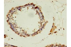 Immunohistochemistry of paraffin-embedded human testis tissue using ABIN7150446 at dilution of 1:100