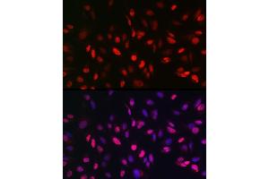 Immunofluorescence analysis of U2OS cells using KDM3A Rabbit pAb (ABIN6134725, ABIN6142790, ABIN6142791 and ABIN6215526) at dilution of 1:150 (40x lens). (KDM3A antibody  (AA 350-450))