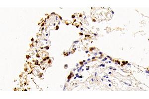 Detection of SPA2 in Human Lung Tissue using Polyclonal Antibody to Surfactant Associated Protein A2 (SPA2) (SFTPA2 antibody  (AA 21-114))