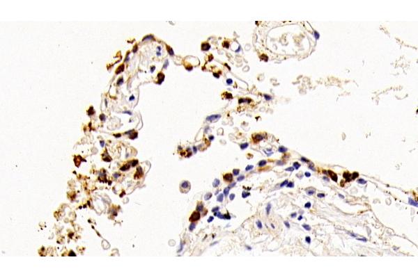 SFTPA2 anticorps  (AA 21-114)