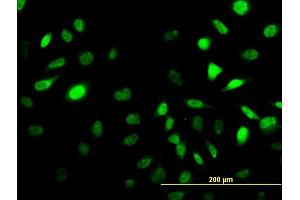 Immunofluorescence of monoclonal antibody to SES2 on HeLa cell. (Sestrin 2 antibody  (AA 1-480))