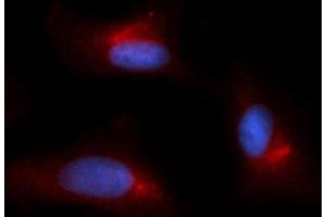 Immunofluorescence (IF) image for anti-Glutamine--Fructose-6-Phosphate Transaminase 1 (GFPT1) (AA 332-699) antibody (PE) (ABIN5568374) (GFPT1 antibody  (AA 332-699) (PE))