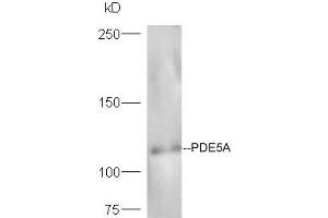 Lane 1: mouse heart probed with Rabbit Anti-Axin1 Polyclonal Antibody, Unconjugated (ABIN740295) at 1:300 overnight at 4 °C. (Axin antibody  (AA 761-862))