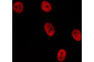 ABIN6276871 staining  COLO205 cells by IF/ICC. (Cyclin D2 antibody  (C-Term))