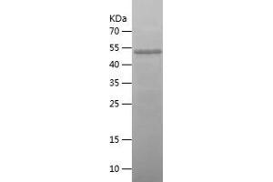 ZYX Protein (AA 2-168) (His-IF2DI Tag)