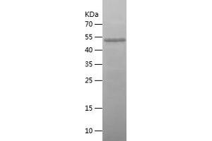 ZYX Protein (AA 2-168) (His-IF2DI Tag)