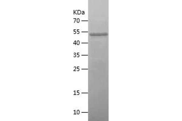 ZYX Protein (AA 2-168) (His-IF2DI Tag)