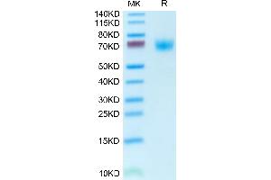 Phospholipase D4 Protein (PLD4) (AA 58-503) (His tag)