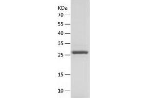 TPI1 Protein (AA 1-249) (His tag)