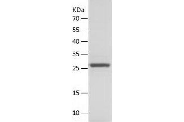 TPI1 Protein (AA 1-249) (His tag)