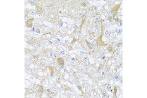 Immunohistochemistry of paraffin-embedded rat brain using SULT1A1 antibody at dilution of 1:100 (x40 lens). (SULT1A1 antibody)