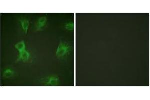 Immunofluorescence analysis of HeLa cells treated with Forskolin 40nM 15', using HRS (Phospho-Tyr334) Antibody. (HRS (HRS) (AA 301-350), (pTyr334) antibody)