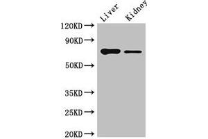 Western Blot Positive WB detected in: Mouse liver tissue, Mouse kidney tissue All lanes: DEF6 antibody at 4 μg/mL Secondary Goat polyclonal to rabbit IgG at 1/50000 dilution Predicted band size: 74 kDa Observed band size: 74 kDa (DEF6 antibody  (AA 20-114))