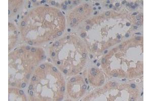 Detection of ABCC2 in Human Kidney Tissue using Polyclonal Antibody to ATP Binding Cassette Transporter C2 (ABCC2) (ABCC2 antibody  (AA 1300-1534))