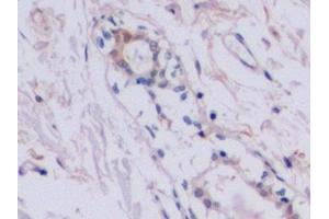 Detection of TIMP2 in Human Mammary gland Tissue using Polyclonal Antibody to Tissue Inhibitors Of Metalloproteinase 2 (TIMP2) (TIMP2 antibody  (AA 27-220))