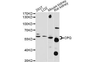 Western blot analysis of extracts of various cell lines, using CPQ antibody (ABIN6293987) at 1:1000 dilution. (CPQ antibody)