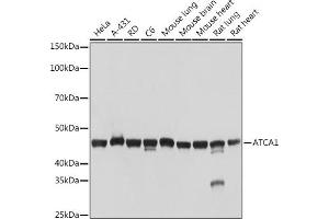Western blot analysis of extracts of various cell lines, using α-Actin-1  Rabbit mAb (ABIN3015986, ABIN3015987, ABIN1680683 and ABIN1680684) at 1:1000 dilution. (Actin antibody)