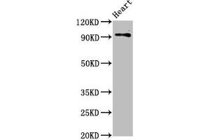 Western Blot Positive WB detected in: Rat heart tissue All lanes: DLG2 antibody at 2.