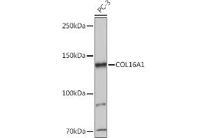 Western blot analysis of extracts of PC-3 cells, using COL16 antibody (8837) at 1:1000 dilution. (COL16A1 antibody  (AA 1000-1100))