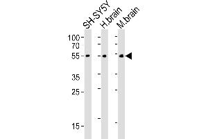 Western blot analysis of lysates from SH-SY5Y cell line, human brain, mouse brain tissue(from left to right), using CHRM2 Antibody (ABIN6242476 and ABIN6577085).