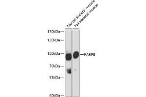 Western blot analysis of extracts of various cell lines, using P antibody (ABIN6133216, ABIN6145242, ABIN6145243 and ABIN6216694) at 1:3000 dilution. (PARP8 antibody  (AA 1-300))