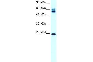 WB Suggested Anti-CLDN8 Antibody Titration:  0. (CLDN8 antibody  (C-Term))