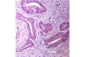 TLR5 Immunohistochemistry. (TLR5 antibody)