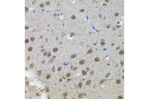 Immunohistochemistry of paraffin-embedded rat brain using MYCN antibody. (MYCN antibody)