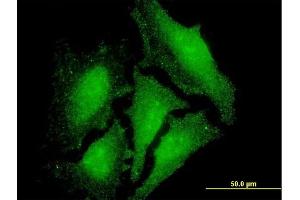 Immunofluorescence of monoclonal antibody to LMO3 on HeLa cell. (LMO3 antibody  (AA 91-146))