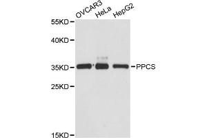Western blot analysis of extracts of various cell lines, using PPCS antibody (ABIN6293765) at 1:3000 dilution. (PPCS antibody)