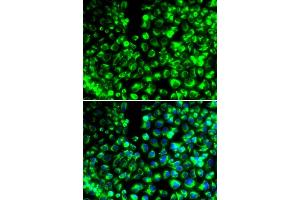 Immunofluorescence analysis of HeLa cells using CALU antibody (ABIN6129532, ABIN6137877, ABIN6137879 and ABIN6216027). (CALU antibody  (AA 20-315))