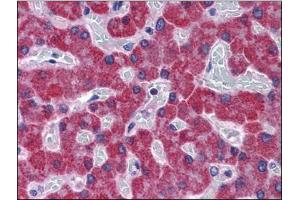 Immunohistochemistry Image: Human Liver: Formalin-Fixed, Paraffin-Embedded (FFPE) (SCD antibody  (C-Term))