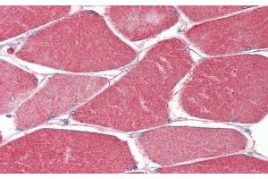 Immunohistochemistry (IHC) image for anti-Muscle, Skeletal, Receptor Tyrosine Kinase (MUSK) (AA 517-777) antibody (ABIN7435772)