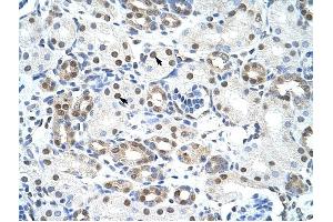 LSM2 antibody was used for immunohistochemistry at a concentration of 4-8 ug/ml to stain Epithelial cells of renal tubule (arrows) in Human Kidney. (LSM2 antibody)