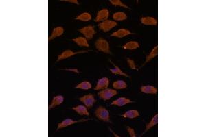 Immunofluorescence analysis of L929 cells using USP19 antibody  at dilution of 1:100. (USP19 antibody  (AA 1-200))