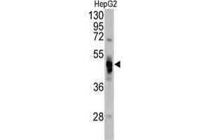 Western blot analysis of GLA antibody (N-term) in Hela cell line lysates (35 µg/lane). (GLA antibody  (N-Term))
