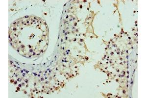 Immunohistochemistry of paraffin-embedded human testis tissue using ABIN7161152 at dilution of 1:100 (NPHP1 antibody  (AA 1-109))