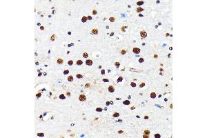 Immunohistochemistry of paraffin-embedded mouse brain using HD antibody (ABIN7267708) at dilution of 1:100 (40x lens). (HDAC2 antibody)