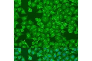 Immunofluorescence analysis of U2OS cells using DCP2 Polyclonal Antibody at dilution of 1:100. (DCP2 antibody)