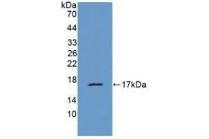 Detection of Recombinant MUC1, Human using Polyclonal Antibody to Mucin 1 (MUC1) (MUC1 antibody  (AA 1034-1151))