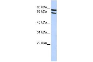 Western Blotting (WB) image for anti-Solute Carrier Family 6 (Neutral Amino Acid Transporter), Member 15 (SLC6A15) antibody (ABIN2458798) (SLC6A15 antibody)