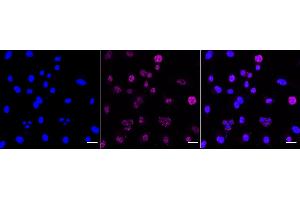 Immunocytochemical staining of C2C12 cells with Phospho-MEK1 (T292) antibody (ABIN7799463), 1:1,000). (Recombinant MEK1 antibody  (pThr292))