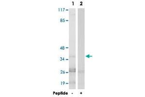 Western blot analysis of extracts from K-562 cells, using CCNH polyclonal antibody . (Cyclin H antibody)
